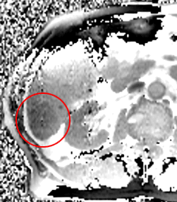 Temperaturmonitoring